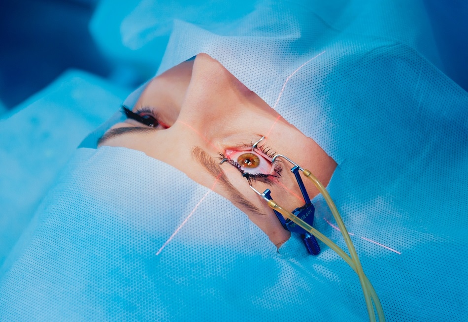 Lasers, Surgery