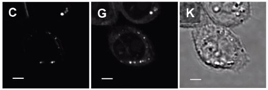 Adapted with permission from2. Copyright 2011 American Chemical Society. The figure shows SRS and transmission images of CHO cells incubated for 7 hours in the cell culture medium supplemented with 100 µM deuterated palmitic acid (exogenous FA with C-D vibration). Figure 4C shows an SRS image of the C-D vibration and indicates the presence of exogenous FA in LD and cell membranes. Figure 4G shows an SRS image at the C-H vibration of the same cells and shows the distribution of endogenous FA in cells. Notably, the location of LD in 4C and 4G indicates that even when cells are supplemented with exogenous FA, intra-cellular LD contain both endogenous and exogenous FA. This suggests that the cell still synthesizes endogenous FA to facilitate the LD formation. The transmission image in Figure 4K lacks any chemical information found in the SRS images. Scale bar: 5 µm.