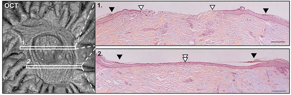 Comparison of 1300 nm SS-OCT en-face imaging to cross-sectional histologic analysis at two points on a healing wound.