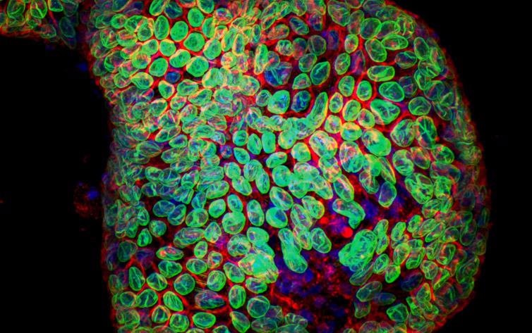 Organoid image. Image acquired with Dragonfly spinning disk confocal system using 25 um pinhole.