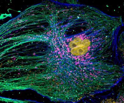 Mammalian cell cytoskeleton. Image acquired with Dragonfly spinning disk confocal microscope using an iXon 888 EMCCD camera.