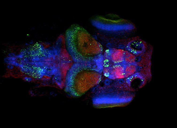 Neural system in Zebrafish larvae. Image acquired with Dragonfly spinning disk microscope using an inverted microscope stand. Simultaneous acquisition with two Zyla sCMOS cameras, band pass dichroic 25 um pinhole, and single band pass emission filters.