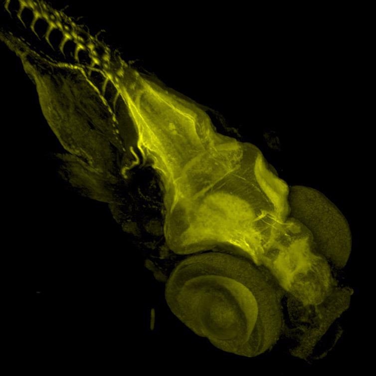 Zebrafish stained with Acetylated Tubulin. Image acquired with Dragonfly spinning disk microscope using a Sona 4.2B6 sCMOS camera.