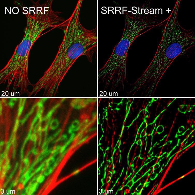 BPA cells stained with phalloidin (red), mitotracker (green) and DAPI (blue) where imaged with Ixon 888 Ultra in confocal mode (no SRRF) and confocal mode with SRRF-stream+. Image acquired with Dragonfly spinning disk microscope using an Ixon 888 EMCCD camera.