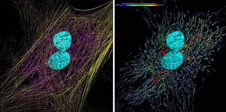 Mammalian cells presenting actin, mitochondria and DNA. Image acquired with Andor Dragonfly 500, an iXon 88 camera and using SRRF-Stream+ imaging modality. Image was processed with Imaris 9.7. The actin filaments (yellow) were segmented with the Surface component.