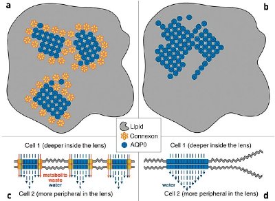 Representation of the structural differences between healthy (a) and cataract (b) membranes. In healthy membranes, themomogeneous distribution of contact areas ensures normal communication between neighboring cells (c) whereas in cataract membranes, the lack of connexons results in abnormal cell-to-cell adhesion (d). Furthermore, the absence of connexons in the unhealthy tissue results in cellular starvation and waste accumulation