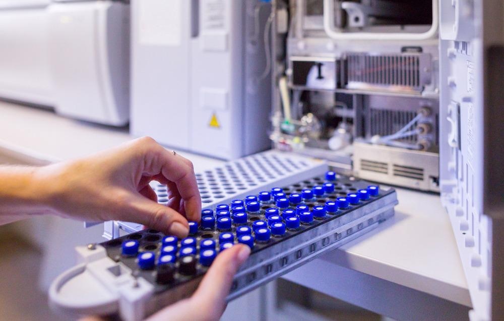 mass spectrometry, lipidomics