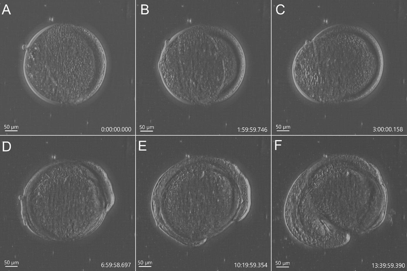 Stain free imaging of Zebrafish development using DPC imaging modality from BC43. Single field image of live Zebrafish embryo image with BC43 using the 10x imaging objective (1,84 mm of field of view). Live embryo imaged from dome stage (A) until 17 h ours post fertilization (F). Embryo at 50% (B) and 75% (C) epiboly, 3- (D) (E) somite stage. Zebrafish embryo was imaged with a 10X objective. Image is a maximum intensity projection of 35 stack, covering a full range of 700 µm, and captured every 20 min for 14 hours. Embryo was incubated at 28 ºC.
