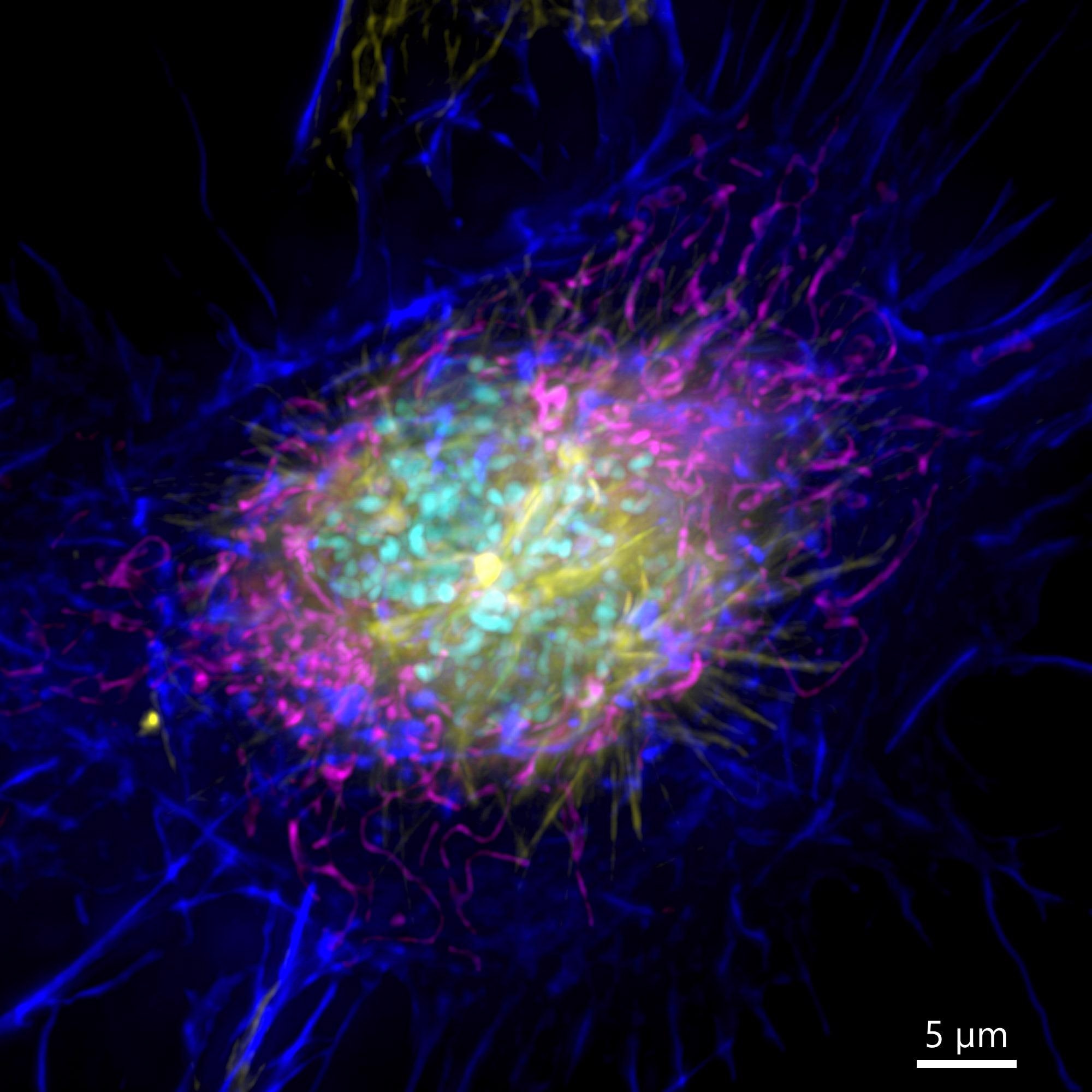 Image of a mammalian cell acquired using widefield modality, using Andor BC43. Image shows the widefield image of a prophase cell ll. Image was further deconvolved after acquisition and is a Maximum intensity projection of 35 Stacks over a 7 µm range. Dark blue-actin, magenta-mitochondria, yellow-microtubules, Cyan-DNA.