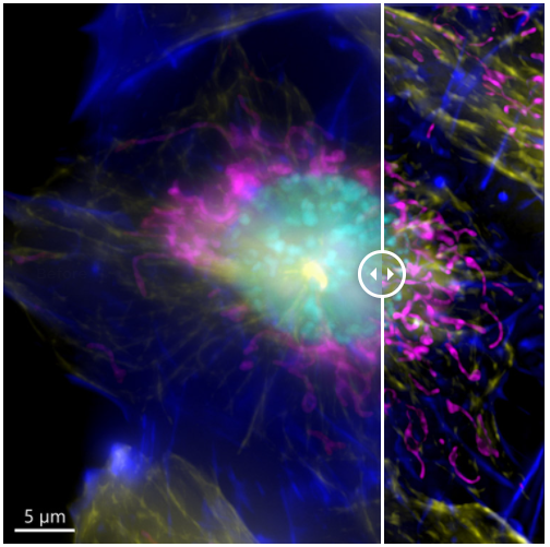 Image of a mammalian cell acquired using widefield modality, using Andor BC43. Image shows the widefield image, before Deconfolution (left), and after deconvolution (right). Image is a Maximum intensity projection of 35 Stacks over a 7 um range. Dark blue-actin, magenta-mitochondria, yellow-microtubules, Cyan-DNA.
