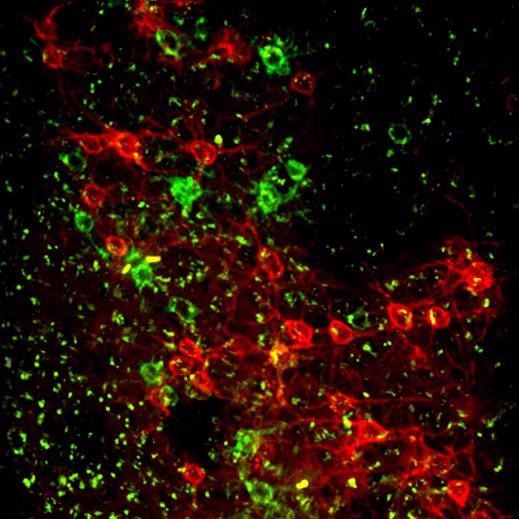 Coronal slice, mouse cortex. Histology of a mouse used for in vivo voltage imaging using Ace-mNeonGreen and Varnam (red) labeled neurons. Both fluorophores express in the cell membrane. Laser source: Fluence Halite (rep. rate 20 MHz, wavelength 1030 nm)