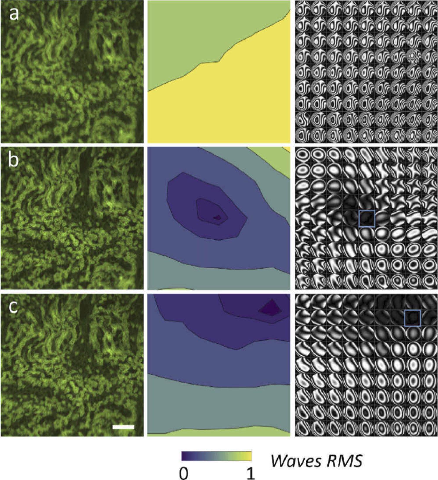 Comparison between the uncorrected and the AL corrected image, with correction in different region. Each raw shows an image of the sample, the RMS error (wavelength?=?530 nm), and the wavefront phase aberrations represented as interferograms in a 9?×?9 grid. (a) Aberrated image without AL. (b) Corrected with AL in the central field. (c) Corrected with AL in the right-top corner. The correction region is indicated by the blue square. Scale bar is 200 µm.