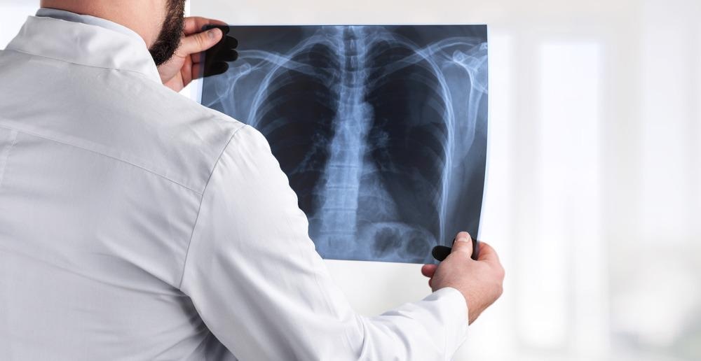 x-ray, history, medical