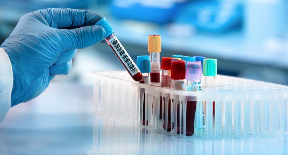 blood biochemistry, blood, Raman spectroscopy