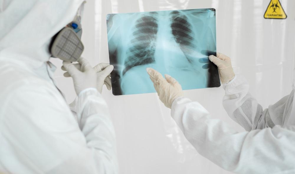 x-ray, lens