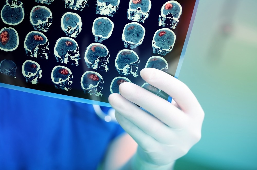 brain imaging