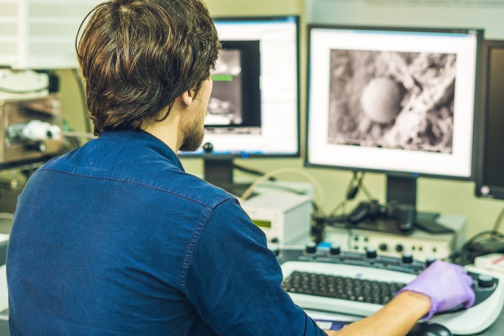 electron microscopy