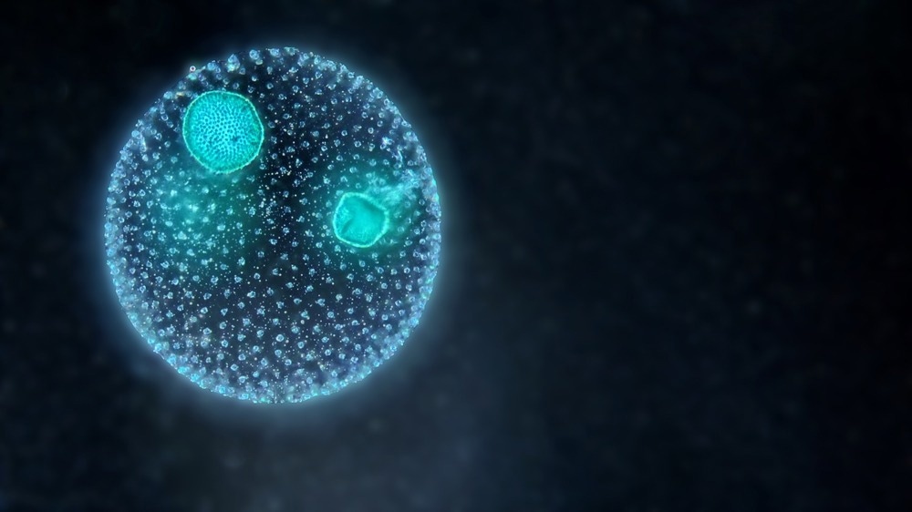Colony of green planktonic algae Volvox under the dark field microscope, dark field microscopy