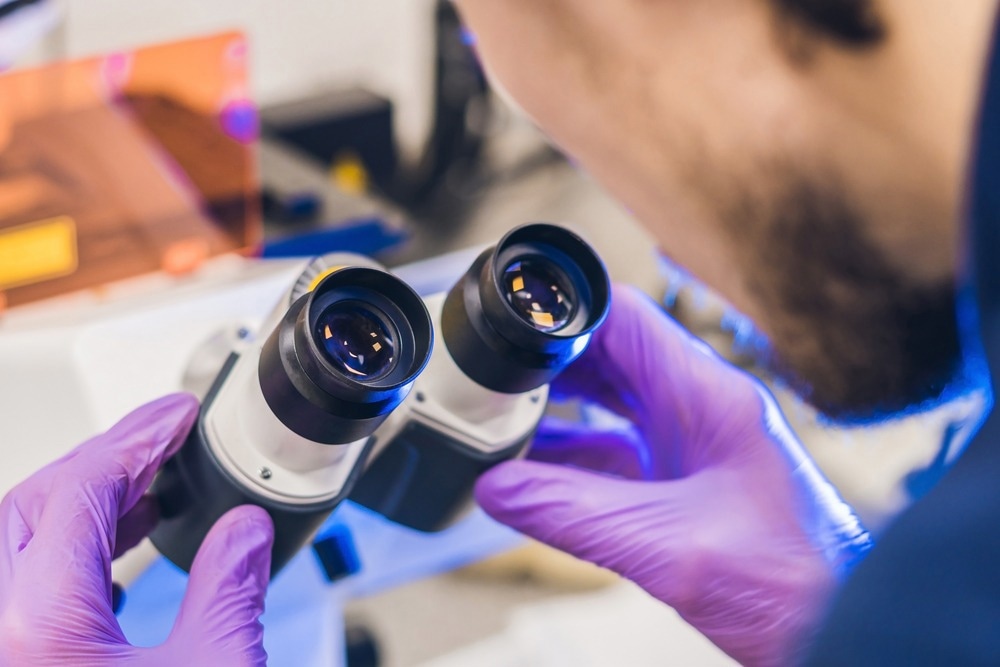 confocal microscopy