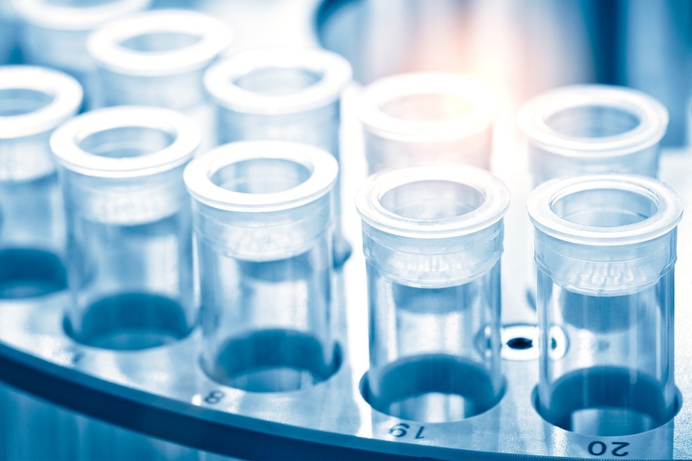 Inductively Coupled Plasma Mass Spectrometry for Elemental Analysis, ICP-MS for elemental analysis