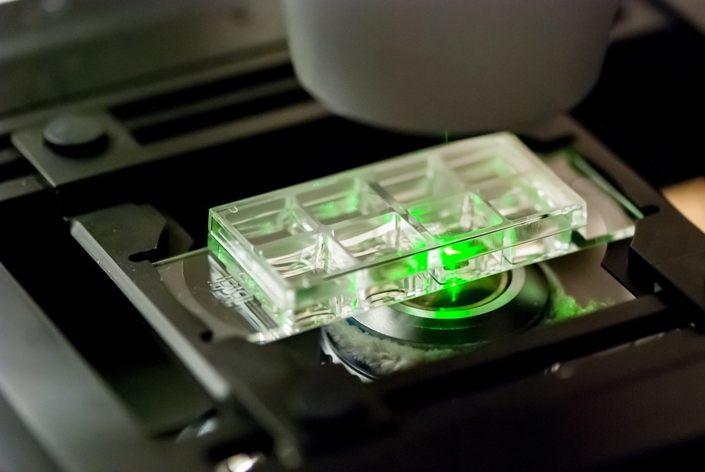 Advancing Laser Scanning Microscopy with SPAD Array Detectors