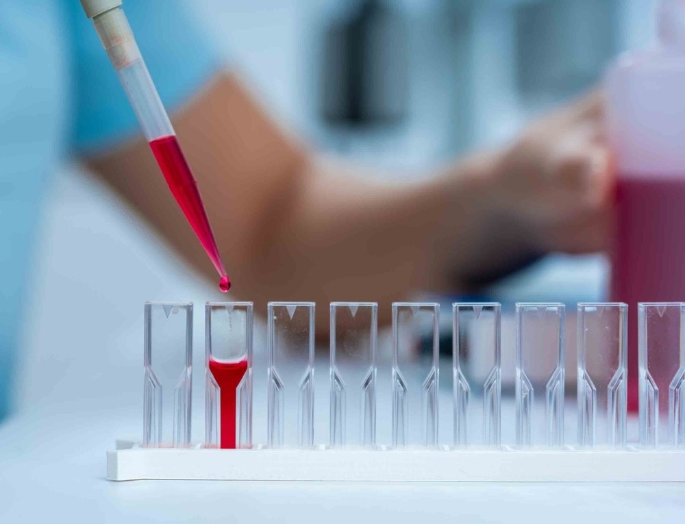 Raman Spectroscopy: A Tool for Conservation