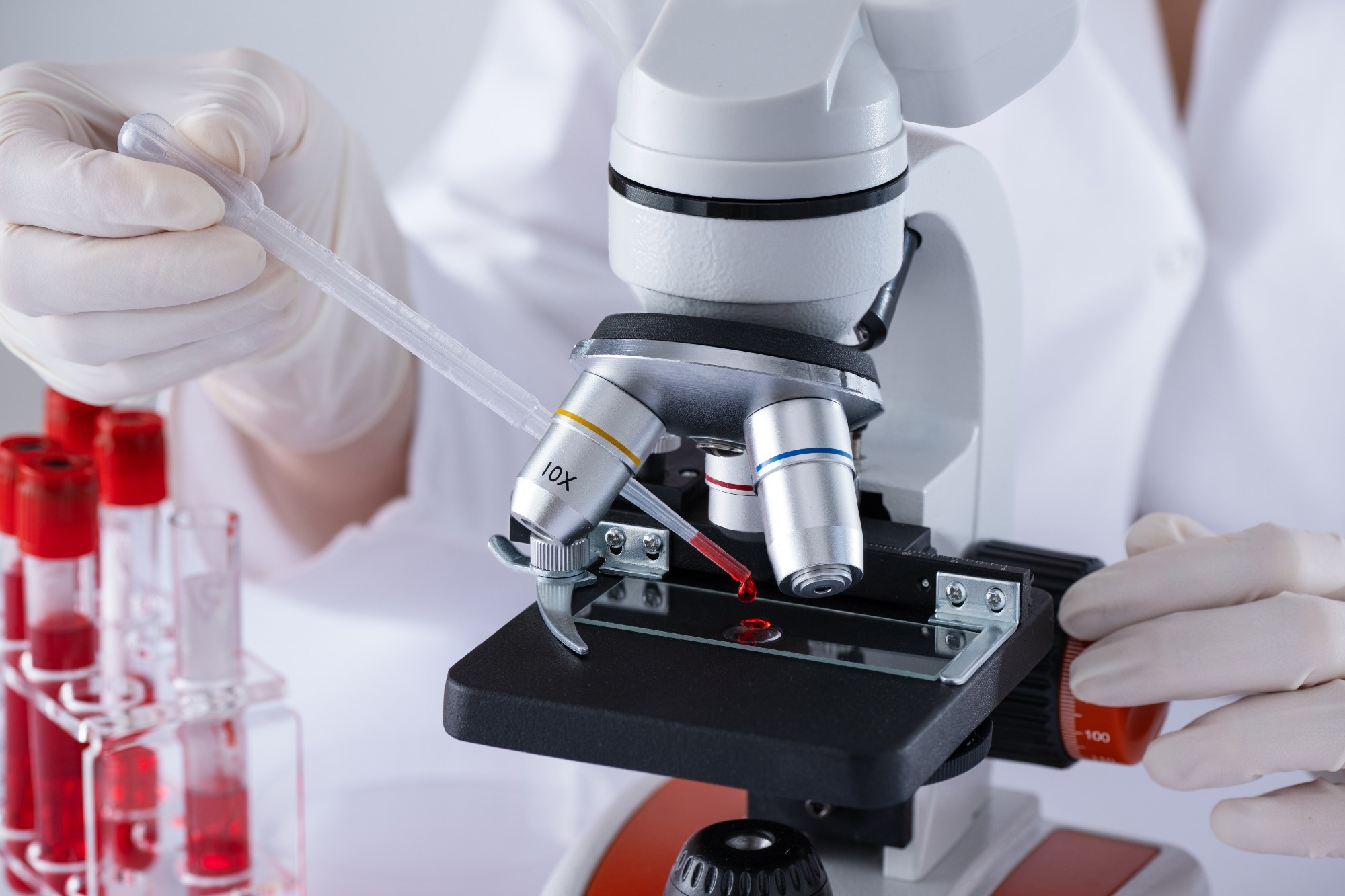 Advanced Microscopy Techniques in STI Detection