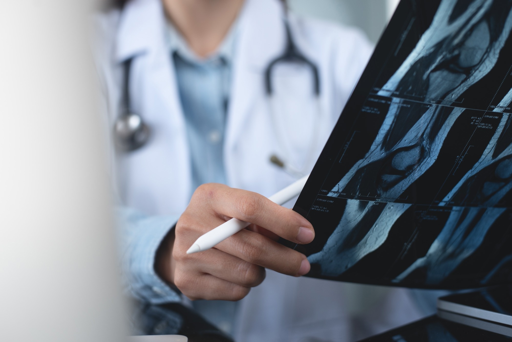 MRIs vs. X-Rays: What Is the Difference?