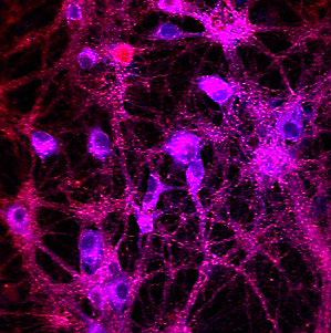 Imaging of cultured rat hippocampal neurons