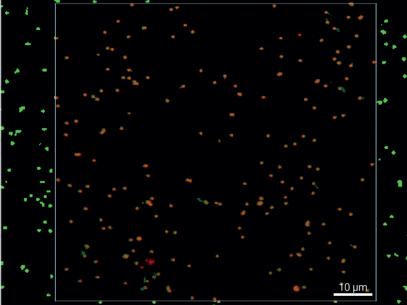 Particle Analysis Overlay. Merge of particle-by-particle and Raman imaging analysis results. White circles indicate particles detected by micro-spectroscopy but missing in the Raman imaging result, while light blue circles highlight particles identified by Raman imaging but not captured in the particle-by-particle approach. Yellow circles mark discrepancies in particle size, arising from differences in the respective size determination methods.