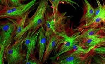 Single Molecule Detection: The Future of Life Science Imaging
