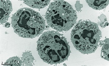 Advancements in Immunolabeling for Electron Microscopy