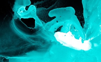 How Non-Destructive Testing Has Revolutionized Medical Imaging