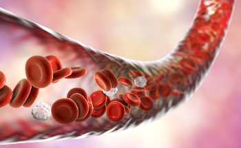 Super-Resolution Photoacoustic Microscopy Finds Clogged Blood Vessels