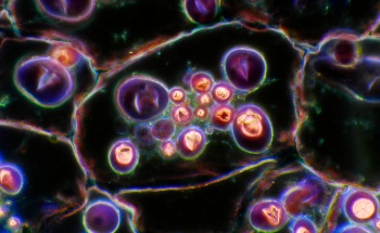 How the Mirrored Chip May Lead the Way to Handheld Dark-Field Microscopes