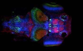 What Impacts the Price of a Confocal Microscope?