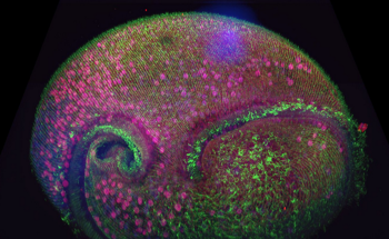 Microscopy Techniques: An Overview