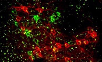 Two-Photon Excited Fluorescence Allows for Higher Quality Biological Imaging