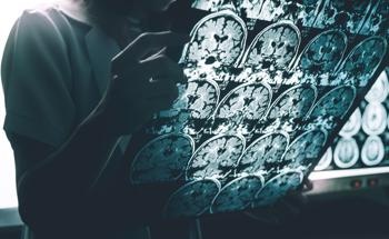 How Can We Use X-Ray Imaging to Better Understand Neurodegenerative Diseases?