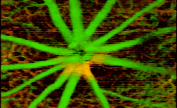 What is OCT Angiography?