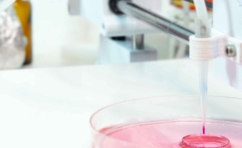 Raman Spectroscopy and Acoustic Bioprinting for Bacteria Identification