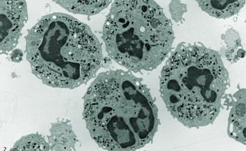 What is the Difference Between Multimodal and Correlative Microscopy?