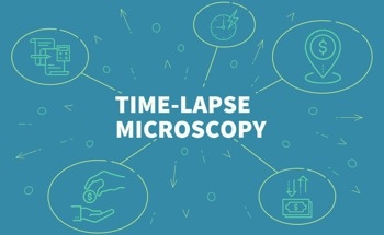Time-Lapse Microscopy in Cell Biology