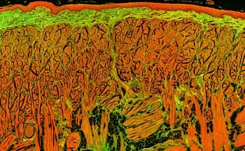 Fluorescence Lifetime Imaging Microscopy for Investigating Molecular Interactions