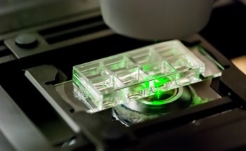 Advancing Laser Scanning Microscopy with SPAD Array Detectors