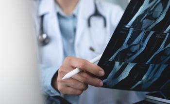 MRIs vs. X-Rays: What Is the Difference?