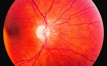 Digital Refocusing Breakthrough Simplifies Retinal Imaging Exams