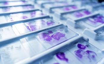 How Small Can You See with Optical Techniques