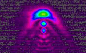 Advancing Non-Invasive Glucose Monitoring with Mid-IR Lasers