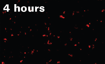 Detecting Polyethylene Microplastics in Liver Tissue with Raman Microscopy